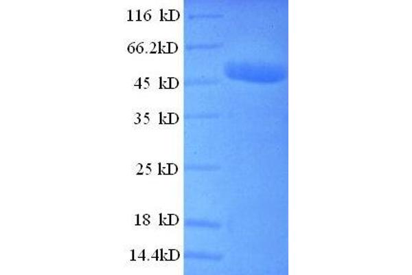 CSNK2B Protein (AA 2-215, partial) (GST tag)