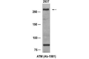 Western blot analysis of extract from 293T cells, using ATM (Ab-1981) Antibody (E021147). (ATM Antikörper)