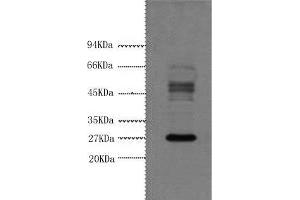 Western Blot analysis of Hela cells using Galectin 3 Monoclonal Antibody at dilution of 1:3000. (Galectin 3 Antikörper)