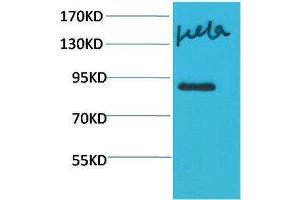 Western Blotting (WB) image for anti-Signal Transducer and Activator of Transcription 4 (STAT4) antibody (ABIN3181592) (STAT4 Antikörper)