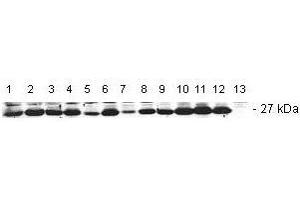 Western Blotting (WB) image for anti-B-Cell CLL/lymphoma 2 (BCL2) (AA 62-76) antibody (ABIN6656060)