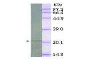 Image no. 2 for anti-Interleukin 18 (IL18) antibody (ABIN791564) (IL-18 Antikörper)