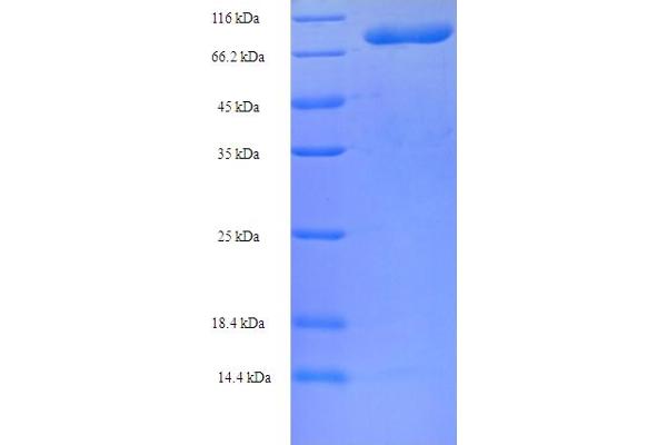 CCT2 Protein (AA 2-535) (His-SUMO Tag)