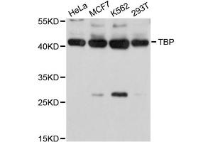Western blot analysis of extracts of various cell lines, using TBP antibody (ABIN5971218) at 1/1000 dilution. (TBP Antikörper)