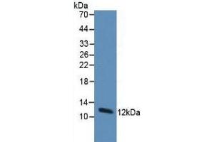 Western Blotting (WB) image for Thioredoxin (TXN) ELISA Kit (ABIN6574192)