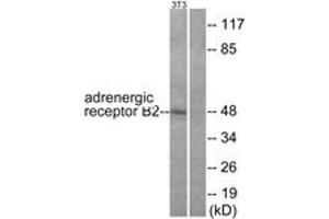 Western blot analysis of extracts from NIH-3T3 cells, using Adrenergic Receptor beta2 (Ab-346) Antibody. (beta 2 Adrenergic Receptor Antikörper  (AA 321-370))