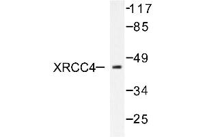Image no. 1 for anti-X-Ray Repair Complementing Defective Repair in Chinese Hamster Cells 4 (XRCC4) antibody (ABIN271982) (XRCC4 Antikörper)