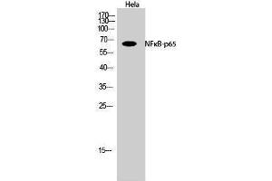 Western Blotting (WB) image for anti-Nuclear Factor-kB p65 (NFkBP65) (Thr735) antibody (ABIN3185891) (NF-kB p65 Antikörper  (Thr735))