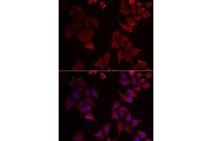 Immunofluorescence analysis of U2OS cells using NCR1 antibody. (NCR1 Antikörper)