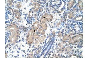 FOXR2 antibody was used for immunohistochemistry at a concentration of 2. (FOXR2 Antikörper  (N-Term))