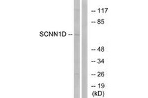 Western blot analysis of extracts from RAW264. (SCNN1D Antikörper  (AA 411-460))