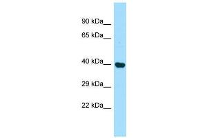 Host:  Rabbit  Target Name:  Pdcd2  Sample Type:  Rat Kidney lysates  Antibody Dilution:  1. (PDCD2 Antikörper  (Middle Region))
