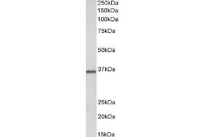 ABIN2564722 (2µg/ml) staining of Pig Brain lysate (35µg protein in RIPA buffer). (PRMT2 Antikörper  (Internal Region))