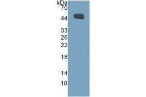 Western Blotting (WB) image for Mucin 1 (MUC1) ELISA Kit (ABIN6730894)