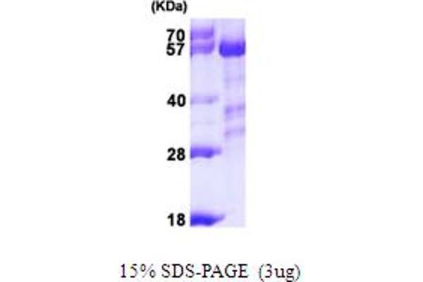 PPP3CA Protein (AA 1-511) (His tag)