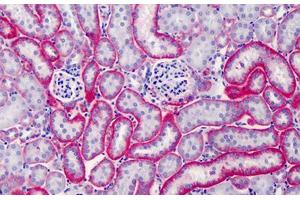 Mouse Kidney: Formalin-Fixed, Paraffin-Embedded (FFPE) (CD147 Antikörper)