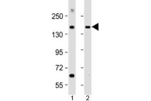 Western blot testing of human 1) brain and 2) lung lysate with MTUS1 antibody at 1:2000. (MTUS1 Antikörper  (AA 183-226))