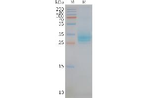 Human CD151-Nanodisc, Flag Tag on SDS-PAGE (CD151 Protein (CD151))