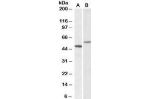 Western blot testing of human hippocampus [A] and HeLa [B] lysates with CD47 antibody at 0. (CD47 Antikörper)
