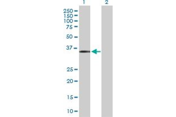 MAGEF1 Antikörper  (AA 1-307)