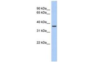 Image no. 1 for anti-Aquaporin 10 (AQP10) (C-Term) antibody (ABIN6743550) (Aquaporin 10 Antikörper  (C-Term))