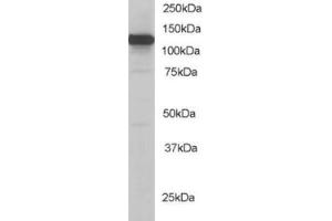 Western Blotting (WB) image for anti-Kinesin Family Member 5B (KIF5B) (C-Term) antibody (ABIN2465236) (KIF5B Antikörper  (C-Term))
