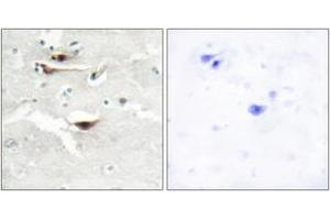 Immunohistochemistry analysis of paraffin-embedded human brain tissue, using IPPK Antibody. (IPPK Antikörper  (AA 11-60))