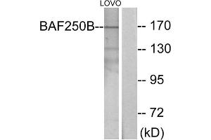 Western blot analysis of extracts from LOVO cells, using BAF250B antibody. (ARID1B Antikörper  (Internal Region))