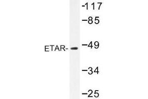 Image no. 1 for anti-Endothelin Receptor Type A (EDNRA) antibody (ABIN317861) (Endothelin-1 Receptor Antikörper)
