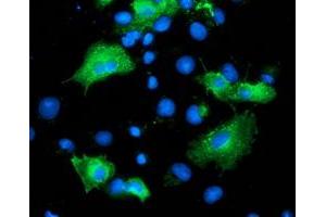 Immunofluorescence (IF) image for anti-ADP-Ribosylation Factor GTPase Activating Protein 1 (ARFGAP1) antibody (ABIN1496684) (ARFGAP1 Antikörper)