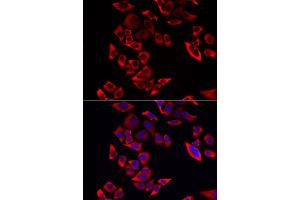 Immunofluorescence analysis of MCF-7 cell using RPL9 antibody. (RPL9 Antikörper)