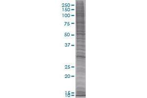 ORC6L transfected lysate (ORC6L 293T Cell Transient Overexpression Lysate(Denatured))