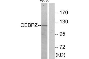Western blot analysis of extracts from COLO cells, using C/EBP zeta antibody. (DDIT3 Antikörper  (N-Term))