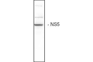 Western blot analysis of the HCV NS5B expression in Huh7 cells (Hepatitis C Virus Antikörper)