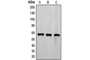 Western blot analysis of TEL expression in CCRFCEM (A), Jurkat (B), K562 (C) whole cell lysates. (ETV6 Antikörper  (C-Term))