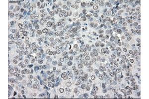 Immunohistochemical staining of paraffin-embedded colon tissue using anti-PPP5Cmouse monoclonal antibody. (PP5 Antikörper)