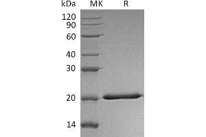 IL28A Protein (His tag)