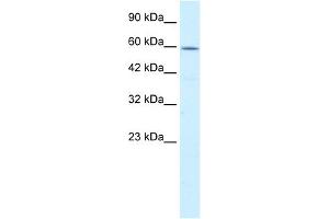 WB Suggested Anti-CCT4 Antibody Titration:  0. (CCT4 Antikörper  (C-Term))
