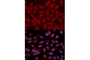 Immunofluorescence analysis of U2OS cells using RAPGEF3 antibody. (RAPGEF3 Antikörper)