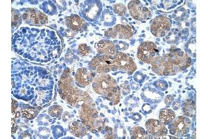 ASS1 antibody was used for immunohistochemistry at a concentration of 4-8 ug/ml to stain Epithelial cells of renal tubule (arrows) in Human Kidney. (ASS1 Antikörper  (C-Term))