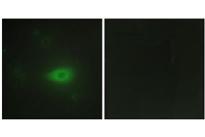 Immunofluorescence analysis of HepG2 ells, using HARS antibody. (HARS1/Jo-1 Antikörper  (C-Term))