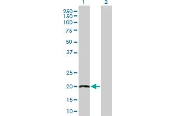 TWIST2 Antikörper  (AA 1-160)