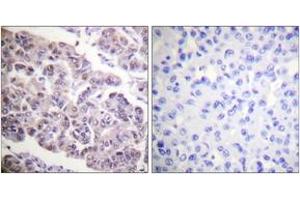 Immunohistochemistry (IHC) image for anti-Histone H4 (acLys12) antibody (ABIN2890734) (Histone H4 Antikörper  (acLys12))