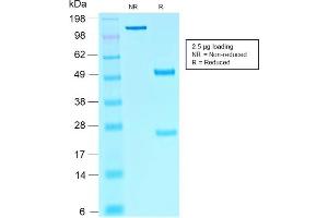 SDS-PAGE (SDS) image for anti-SRY (Sex Determining Region Y)-Box 10 (SOX10) (AA 115-269) antibody (ABIN6940627)