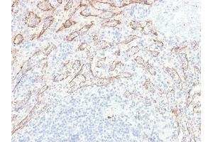 Immunohistochemistry (IHC) image for anti-Tumor Necrosis Factor (Ligand) Superfamily, Member 15 (TNFSF15) antibody (ABIN6941291)