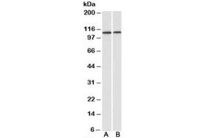 Western blot testing of human heart [A] and kidney [B] lysates with BMP antibody at 1ug/ml. (BMP Antikörper)
