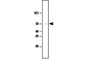 Recombinant SET7/9 was resolved by electrophoresis, transferred to PVDF membrane and probed with anti-SET7/9(1:1,000). (SET7/9 Antikörper  (AA 1-366))