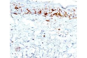 IHC testing of human skin stained with CD1a antibody (C1A/711). (CD1a Antikörper)