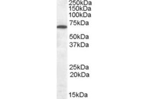 Western Blotting (WB) image for anti-Cannabinoid Receptor 1 (CNR1) (Internal Region) antibody (ABIN2465491) (CNR1 Antikörper  (Internal Region))