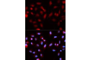 Immunofluorescence (IF) image for anti-Baculoviral IAP Repeat-Containing 5 (BIRC5) antibody (ABIN1875407) (Survivin Antikörper)